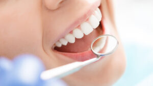 Tips On dental implants singapore